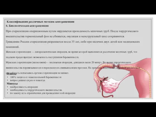 Классификация различных методов контрацепции 6. Биологическая контрацепция При стерилизации операционным путем