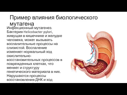 Пример влияния биологического мутагена Инфекционный мутагенез. Бактерия Helicobacter pylori, живущая в