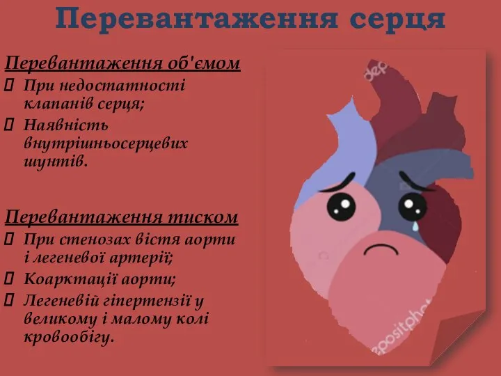 Перевантаження серця Перевантаження тиском При стенозах вістя аорти і легеневої артерії;