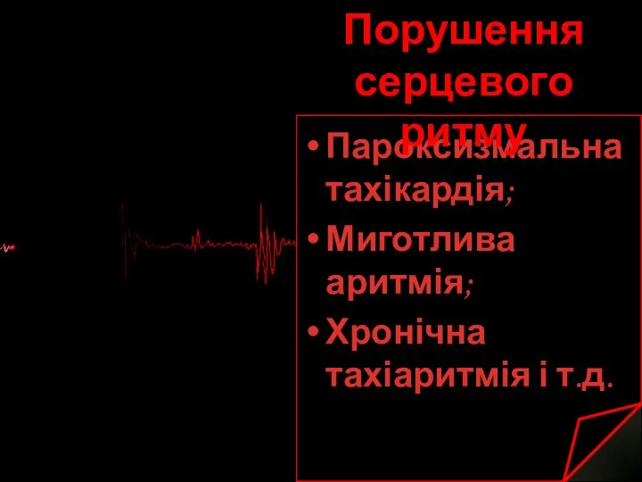 Пароксизмальна тахікардія; Миготлива аритмія; Хронічна тахіаритмія і т.д. Порушення серцевого ритму