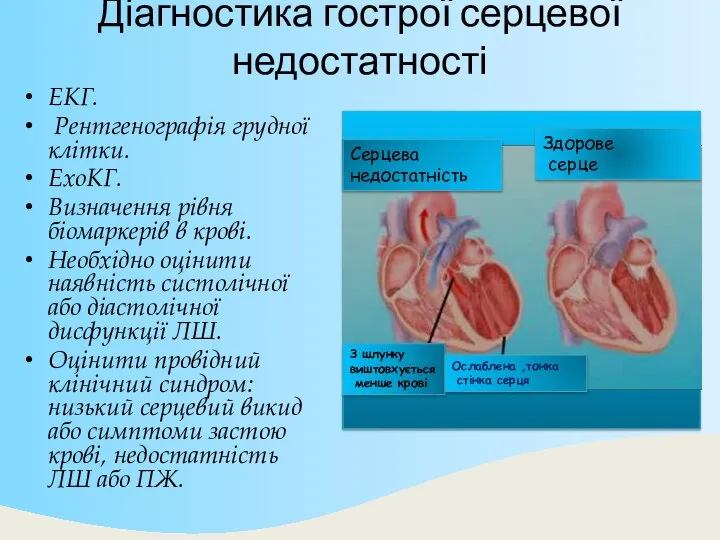 Діагностика гострої серцевої недостатності ЕКГ. Рентгенографія грудної клітки. ЕхоКГ. Визначення рівня