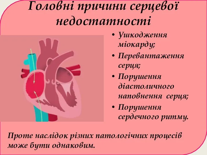 Головні причини серцевої недостатності Ушкодження міокарду; Перевантаження серця; Порушення діастоличного наповнення