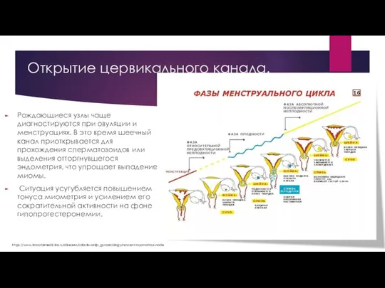 Открытие цервикального канала. Рождающиеся узлы чаще диагностируются при овуляции и менструациях.