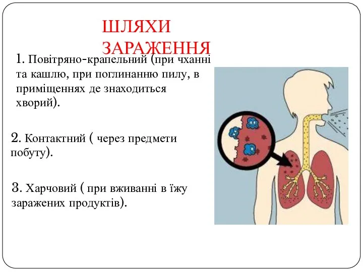 ШЛЯХИ ЗАРАЖЕННЯ 1. Повітряно-крапельний (при чханні та кашлю, при поглинанню пилу,