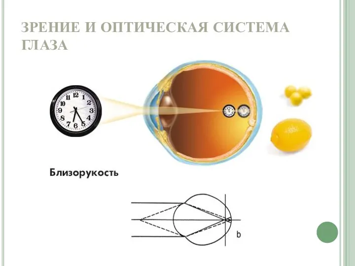 ЗРЕНИЕ И ОПТИЧЕСКАЯ СИСТЕМА ГЛАЗА