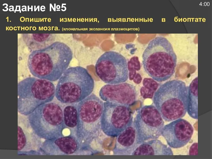 1. Опишите изменения, выявленные в биоптате костного мозга. (клональная экспансия плазмоцитов) Задание №5 4:00