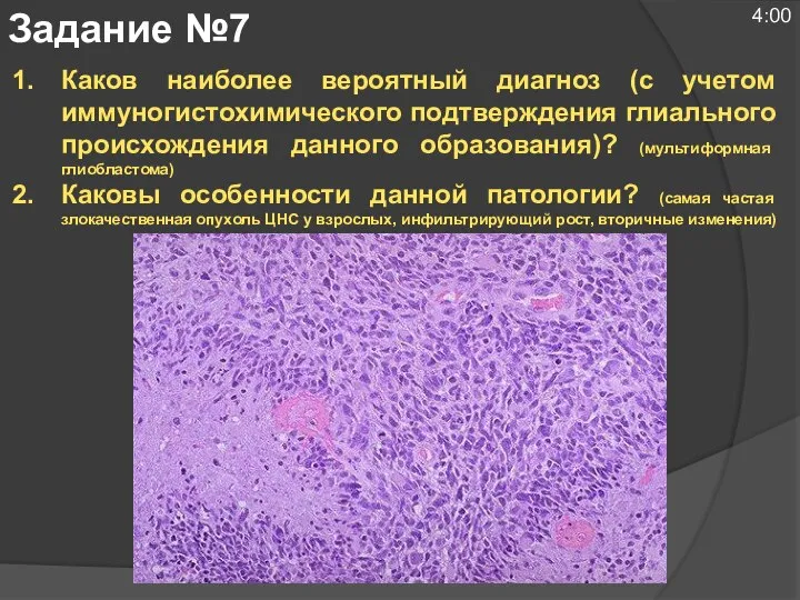 Каков наиболее вероятный диагноз (с учетом иммуногистохимического подтверждения глиального происхождения данного