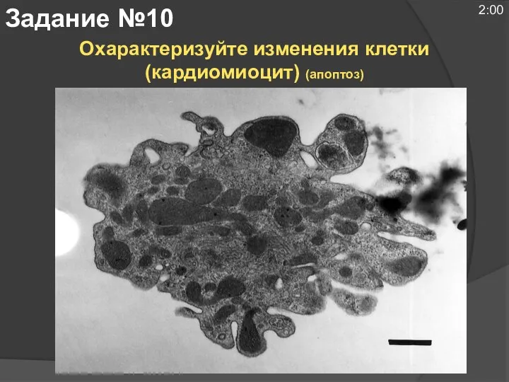 Охарактеризуйте изменения клетки (кардиомиоцит) (апоптоз) Задание №10 2:00