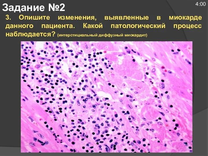 3. Опишите изменения, выявленные в миокарде данного пациента. Какой патологический процесс