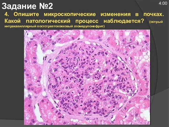 4. Опишите микроскопические изменения в почках. Какой патологический процесс наблюдается? (острый