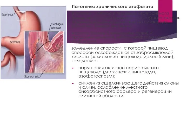 Патогенез хронического эзофагита В основе - заброс в пищевод агрессивного желудочного