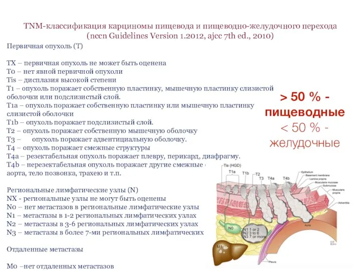 TNM-классификация карциномы пищевода и пищеводно-желудочного перехода (nccn Guidelines Version 1.2012, ajcc