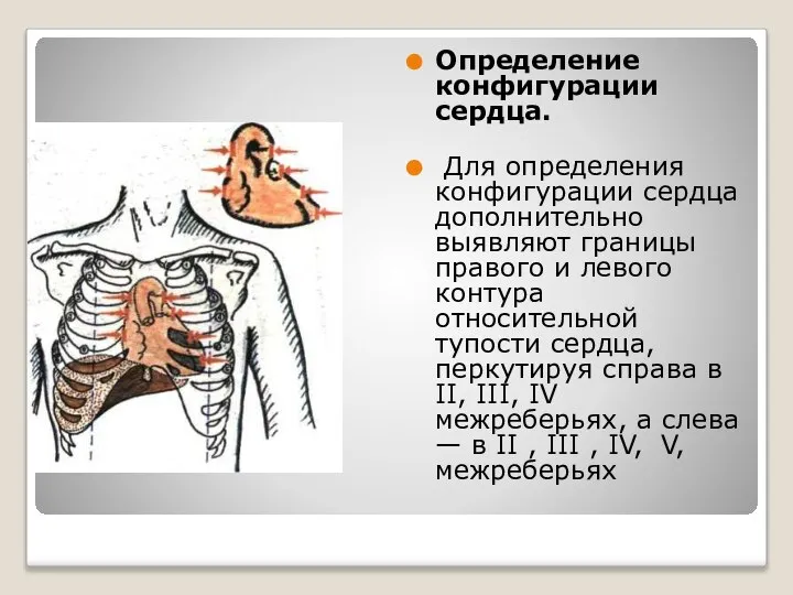 Определение конфигурации сердца. Для определения конфигурации сердца дополнительно выявляют границы правого