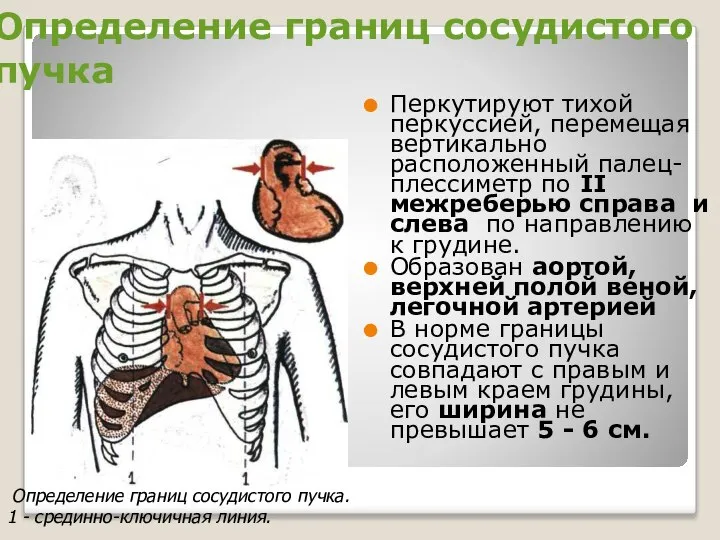 Определение границ сосудистого пучка Перкутируют тихой перкуссией, перемещая вертикально расположенный палец-плессиметр