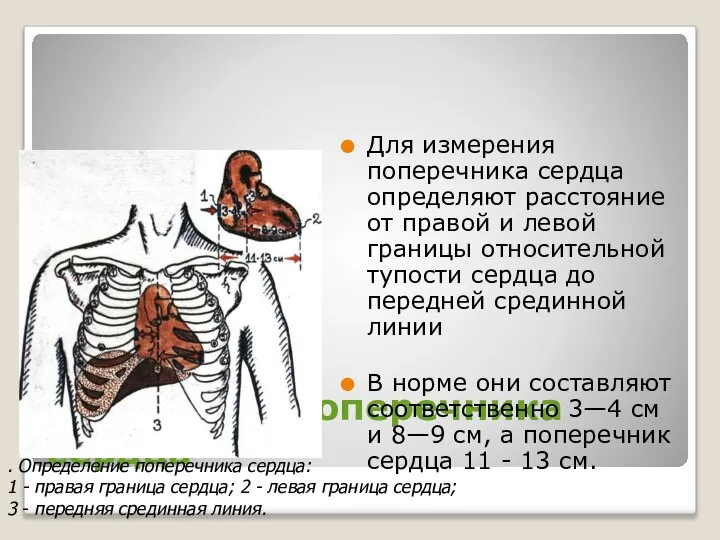 Измерение поперечника сердца Для измерения поперечника сердца определяют расстояние от правой