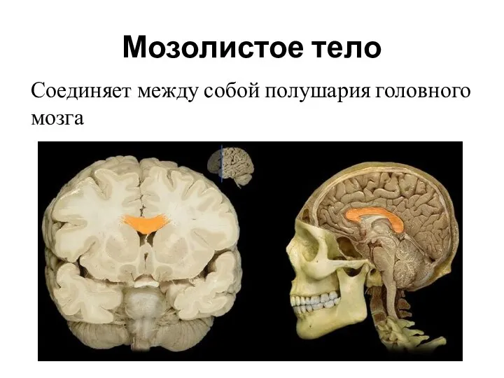 Мозолистое тело Соединяет между собой полушария головного мозга