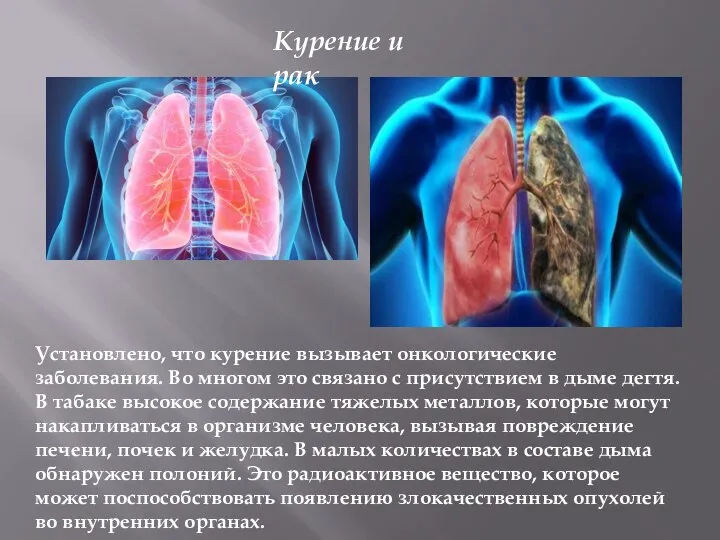 Установлено, что курение вызывает онкологические заболевания. Во многом это связано с