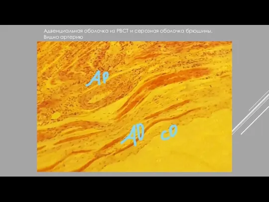 Адвенциальная оболочка из РВСТ и серозная оболочка брюшины. Видно артерию