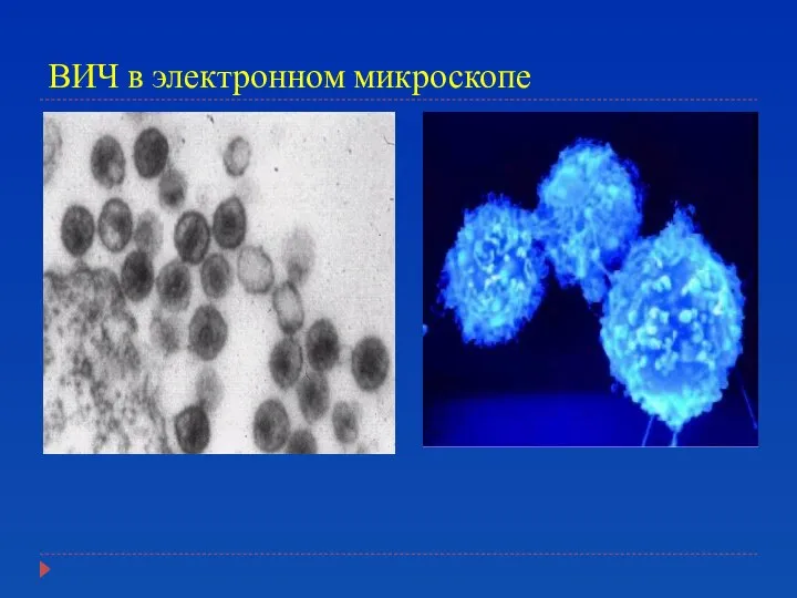 ВИЧ в электронном микроскопе