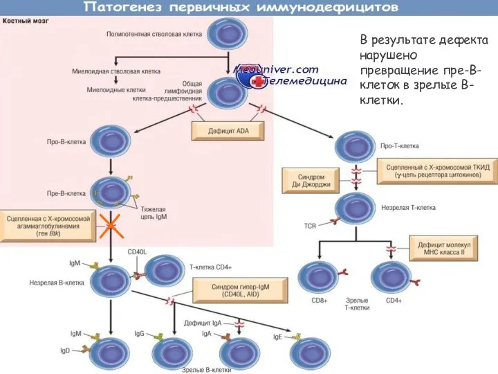 В результате дефекта нарушено превращение пре-В-клеток в зрелые В-клетки.