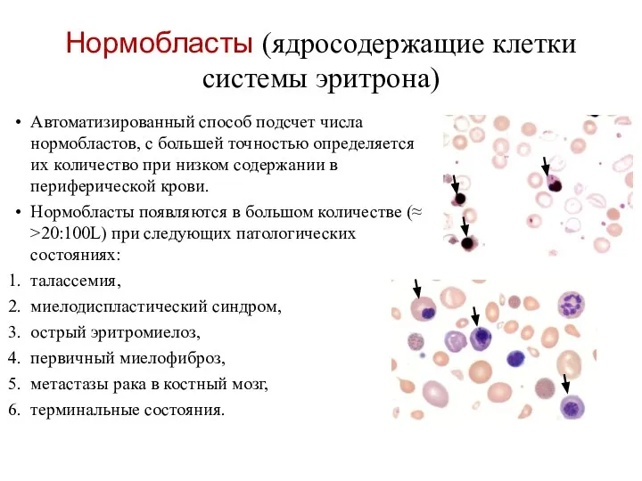 Нормобласты (ядросодержащие клетки системы эритрона) Автоматизированный способ подсчет числа нормобластов, с