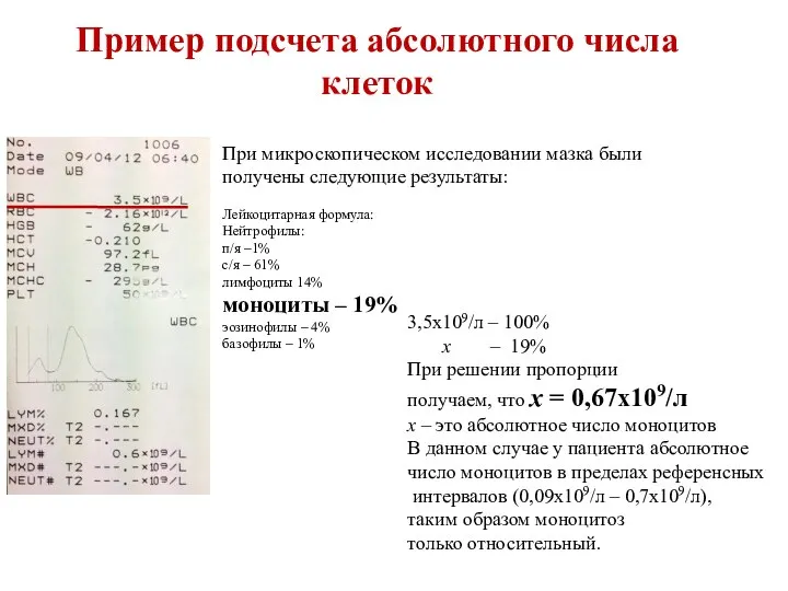 Пример подсчета абсолютного числа клеток При микроскопическом исследовании мазка были получены