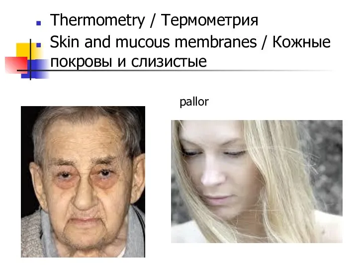 Thermometry / Термометрия Skin and mucous membranes / Кожные покровы и слизистые pallor