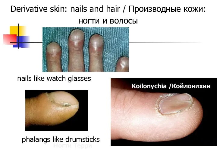 Derivative skin: nails and hair / Производные кожи: ногти и волосы
