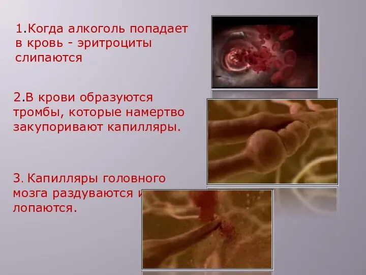 1.Когда алкоголь попадает в кровь - эритроциты слипаются 2.В крови образуются