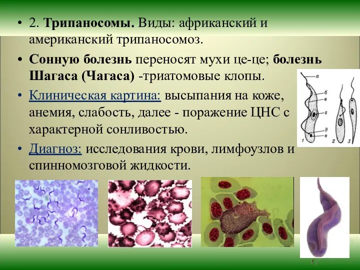 2. Трипаносомы. Виды: африканский и американский трипаносомоз. Сонную болезнь переносят мухи