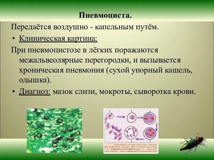 Пневмоциста. Передаётся воздушно - капельным путём. Клиническая картина: При пневмоцистозе в