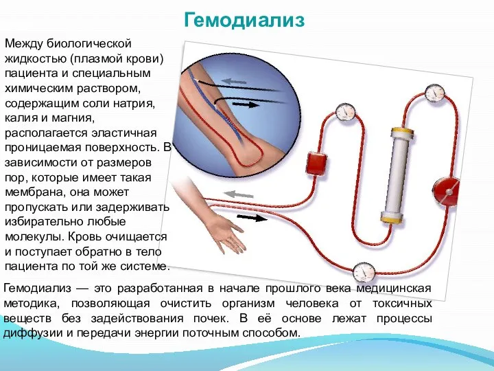 Гемодиализ Гемодиализ — это разработанная в начале прошлого века медицинская методика,