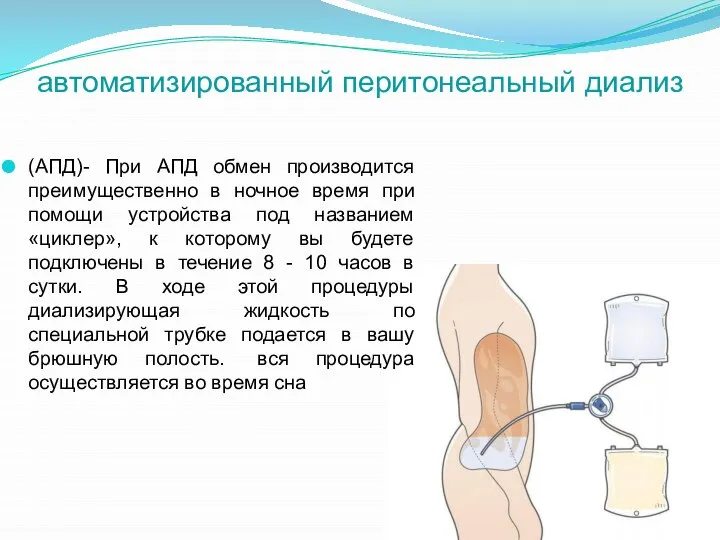 автоматизированный перитонеальный диализ (АПД)- При АПД обмен производится преимущественно в ночное