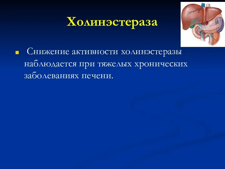 Холинэстераза Снижение активности холинэстеразы наблюдается при тяжелых хронических заболеваниях печени.