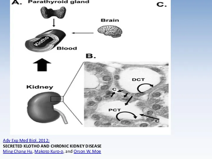 Adv Exp Med Biol. 2012; SECRETED KLOTHO AND CHRONIC KIDNEY DISEASE