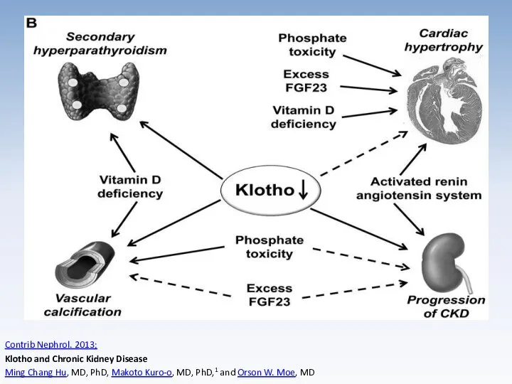 Contrib Nephrol. 2013; Klotho and Chronic Kidney Disease Ming Chang Hu,