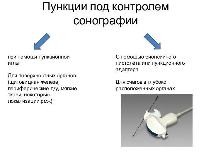 Пункции под контролем сонографии при помощи пункционной иглы Для поверхностных органов