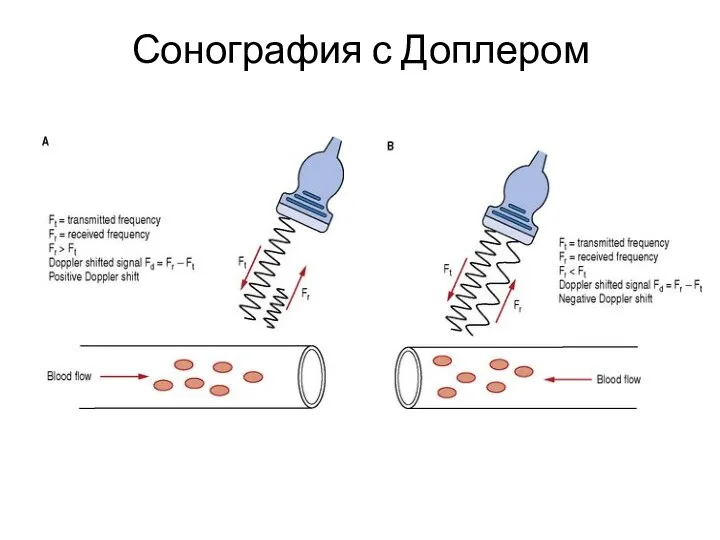 Сонография с Доплером