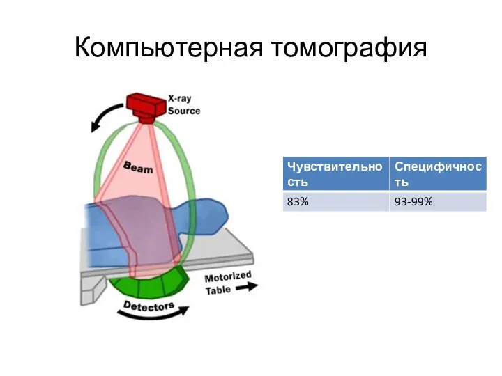 Компьютерная томография