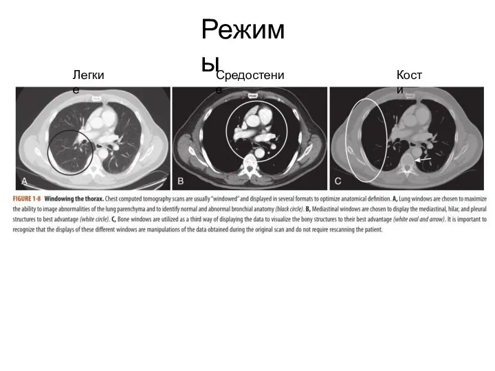 Режимы Легкие Средостение Кости