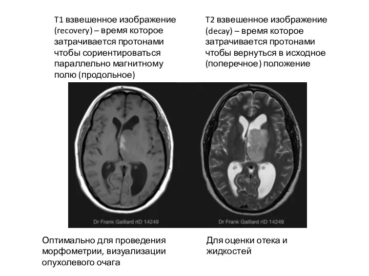 Оптимально для проведения морфометрии, визуализации опухолевого очага Для оценки отека и