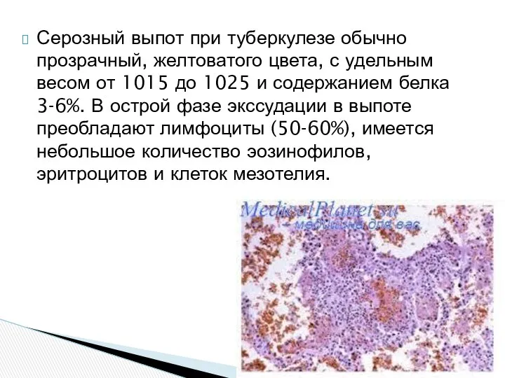 Серозный выпот при туберкулезе обычно прозрачный, желтоватого цвета, с удельным весом