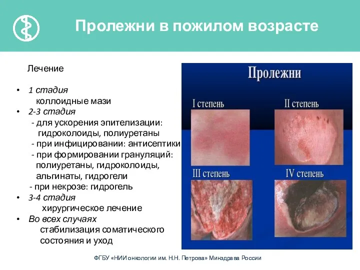 Лечение 1 стадия коллоидные мази 2-3 стадия - для ускорения эпителизации: