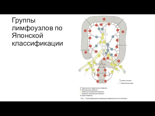 Группы лимфоузлов по Японской классификации