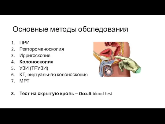 Основные методы обследования ПРИ Ректороманоскопия Ирригоскопия Колоноскопия УЗИ (ТРУЗИ) КТ, виртуальная