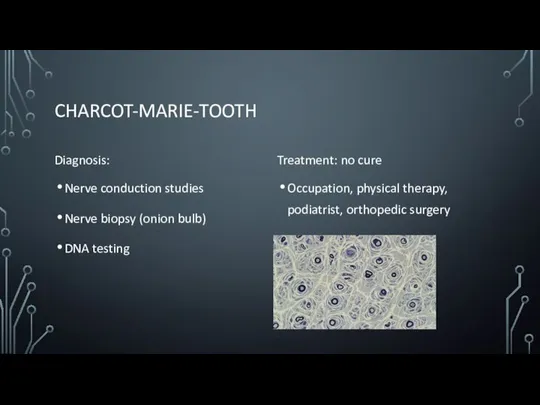 CHARCOT-MARIE-TOOTH Diagnosis: Nerve conduction studies Nerve biopsy (onion bulb) DNA testing