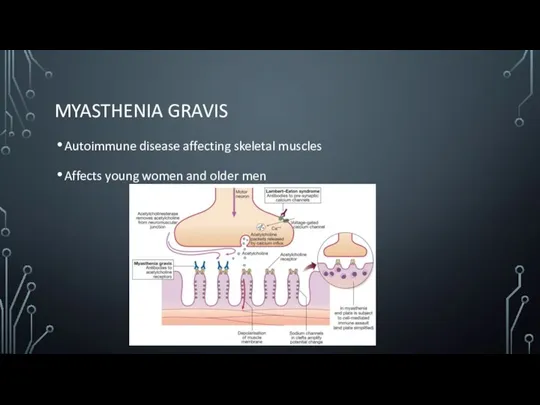 MYASTHENIA GRAVIS Autoimmune disease affecting skeletal muscles Affects young women and older men