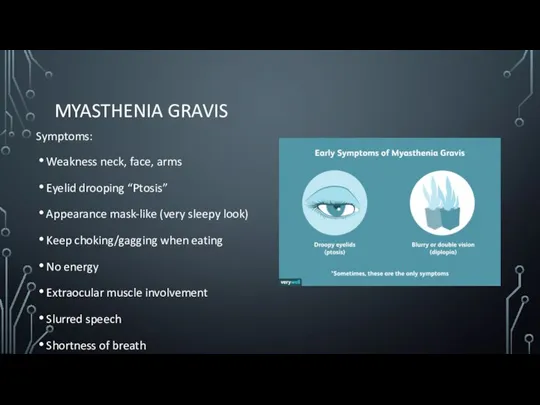 MYASTHENIA GRAVIS Symptoms: Weakness neck, face, arms Eyelid drooping “Ptosis” Appearance