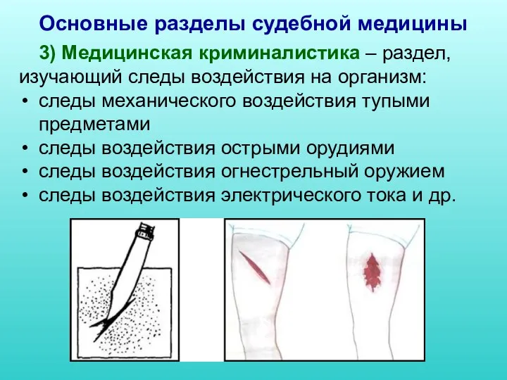 Основные разделы судебной медицины 3) Медицинская криминалистика – раздел, изучающий следы