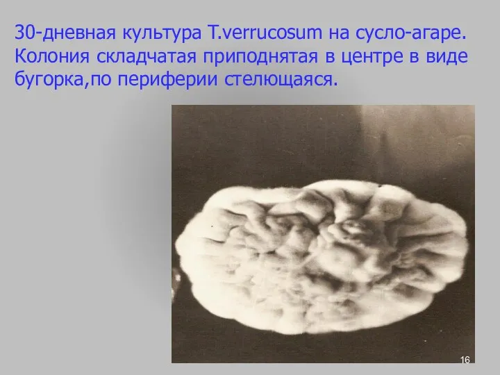 30-дневная культура T.verrucosum на сусло-агаре. Колония складчатая приподнятая в центре в виде бугорка,по периферии стелющаяся.